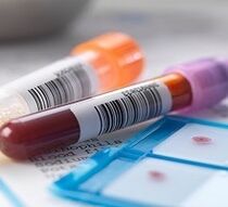 Diagnosis sa laboratoryo sa prostatitis