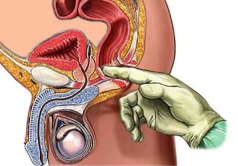 Pagmasahe sa Prostate