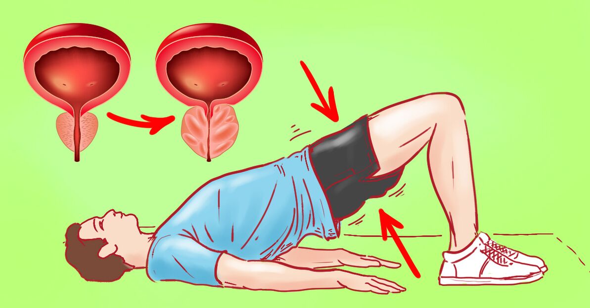 Ang mga ehersisyo sa terapyutik alang sa laygay nga prostatitis