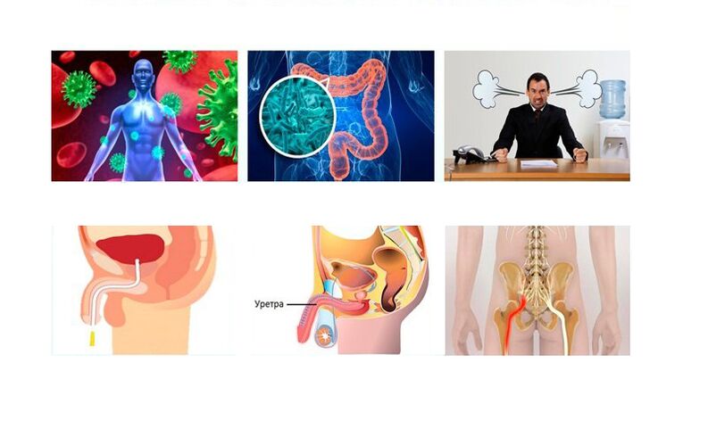 hinungdan sa prostatitis